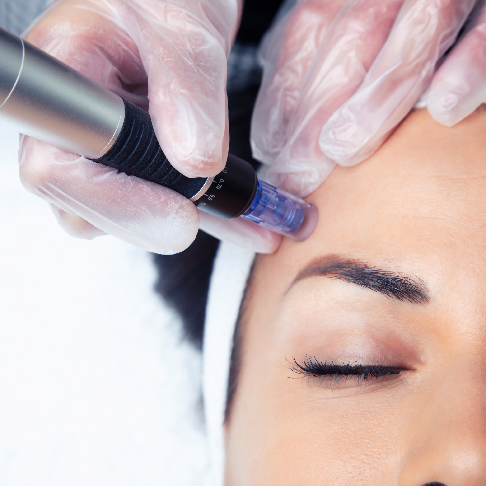 Microneedling treatment in progress at a med spa, featuring a technician using a pen device on a client's forehead, emphasizing aesthetic services and skin rejuvenation.